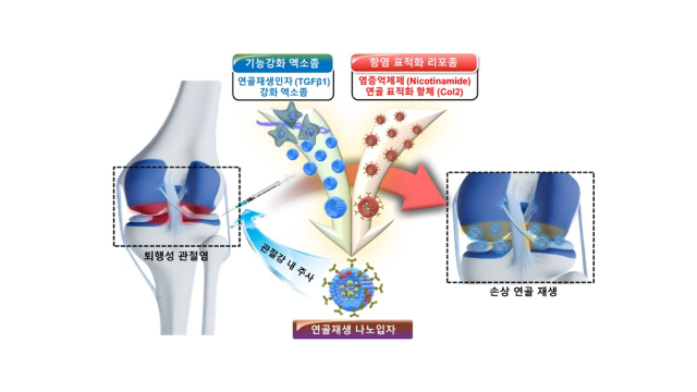 표1 이미지