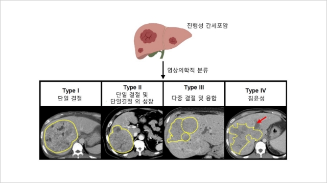 표1 이미지