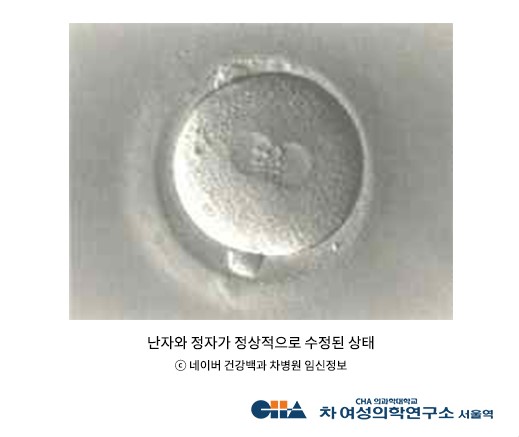 이미지1